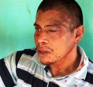 Jehry Rivera, beaten by poachers